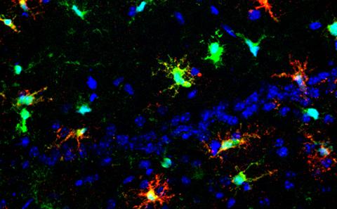 MSc Neurosciences (1 year)